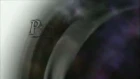 Pandora Hearts episodio 15